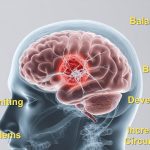 Brain Tumor Symptoms